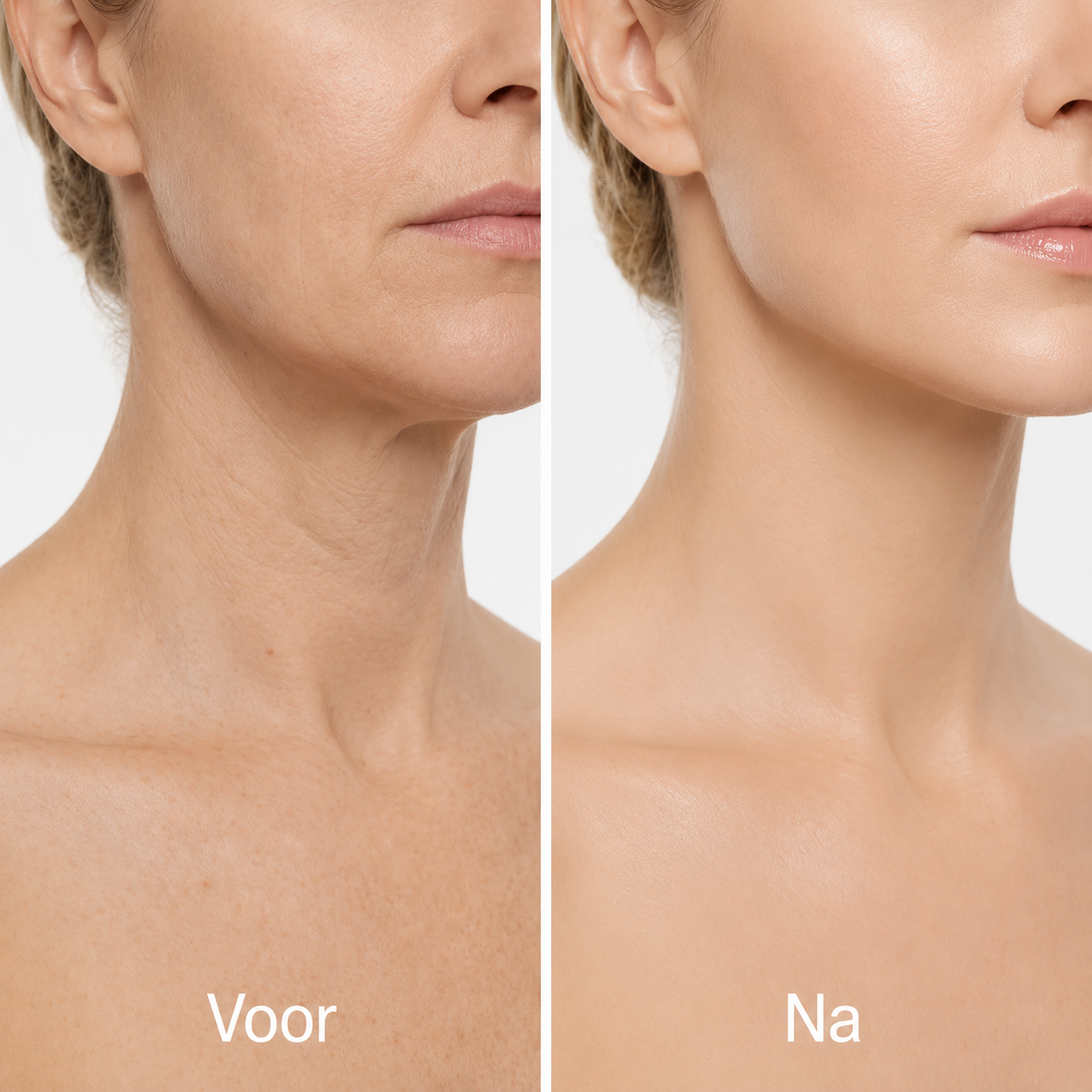 5. Fixes crepey neck skin